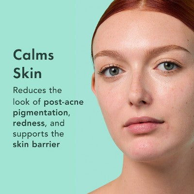 Rael Miracle Clear Complete Acne Treatment Face Serum 1oz