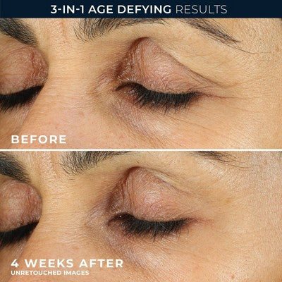 RoC Retinol Correxion Line Smoothing Anti-Aging Wrinkle Eye Cream 0.5 fl oz - Imperfect Box