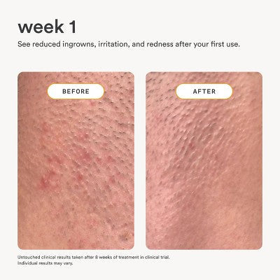 Nood After Care Serum 3.3 fl oz - Imperfect Container