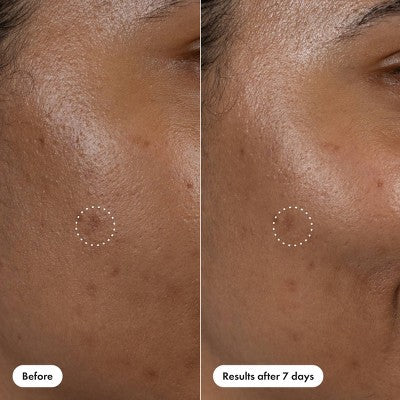 Hero Cosmetics Dark Spot Correct Serum Pen 10ml