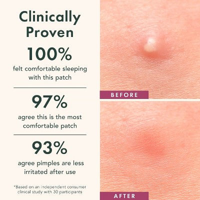 Rael Beauty Miracle Patch Glow and Go Kit 38ct