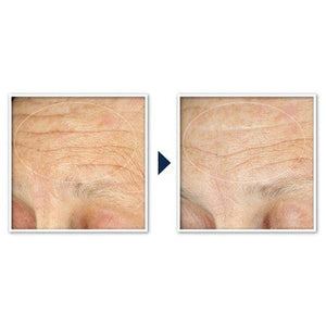 RoC Face & Neck Anti-Aging Moisturizer Firming Cream for Crepey Skin 1.7 fl oz - Imperfect Box