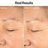 Honest Beauty Ageless Firm and Even Serum 1.0 fl oz - Imperfect Box