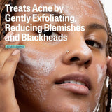 Cetaphil Gentle Clear Salicylic Acid Acne Pore Cleanser 8 fl oz - New