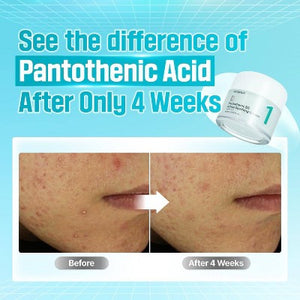 numbuzin No.1 Pantothenic B5 Active Soothing Face Cream 2.7 fl oz - Missing Box