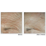 RoC Face & Neck Anti-Aging Moisturizer Firming Cream for Crepey Skin 1.7 fl oz - New