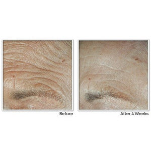 RoC Face & Neck Anti-Aging Moisturizer Firming Cream for Crepey Skin