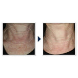 RoC Face & Neck Anti-Aging Moisturizer Firming Cream for Crepey Skin 1.7 fl oz - New