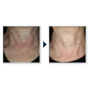 RoC Face & Neck Anti-Aging Moisturizer Firming Cream for Crepey Skin