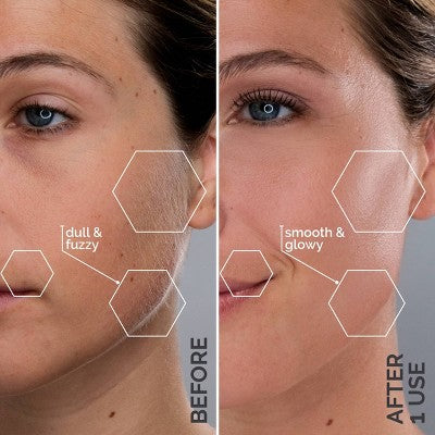 Spa Sciences SIMA Deluxe Sonic Dermaplaning Tool for Exfoliation & Peach Fuzz Removal