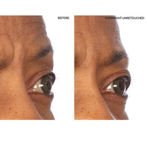 SiO Beauty Super-Lift Pack Brow Eye Smile Patches