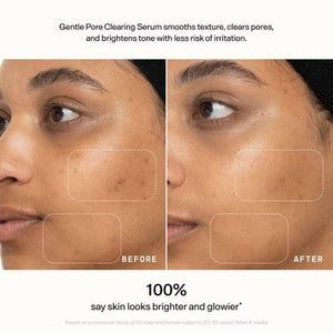 Versed Skin Refine Gentle Pore Clearing Serum 1 fl oz - Imperfect Box