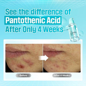 Numbuzin No.1 Pantothenic B5 Active Soothing Serum 1.69 fl oz
