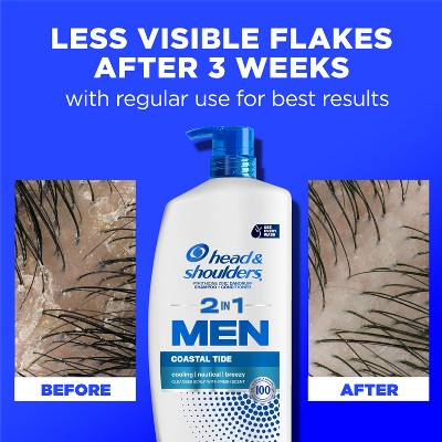 Head & Shoulders Men's 2-in-1 Anti-Dandruff Shampoo and Conditioner 28.2 fl oz