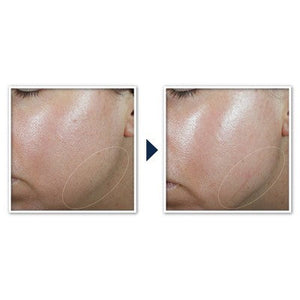RoC Derm Correxion Contour Cream for Face and Neck 1.7oz - Missing Box