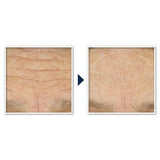 RoC Face & Neck Anti-Aging Moisturizer Firming Cream for Crepey Skin 1.7 fl oz - New