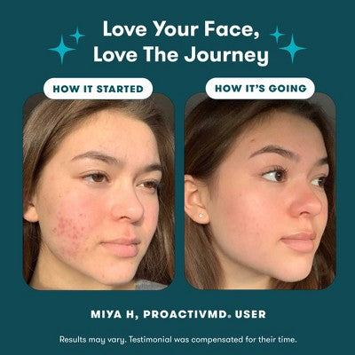 Proactiv MD 30 Day Acne Treatment Kit 3pc - Imperfect Box