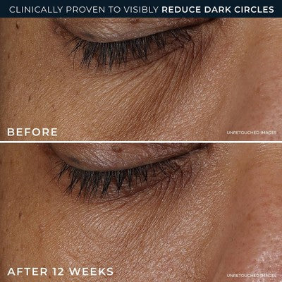 RoC Derm Correxion Dark Circle Eye Repair Cream 15ml - Imperfect Box
