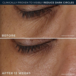 RoC Derm Correxion Dark Circle Eye Repair Cream 15ml - Imperfect Box
