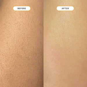 Nood Ingrown Hair Treatment The Eraser