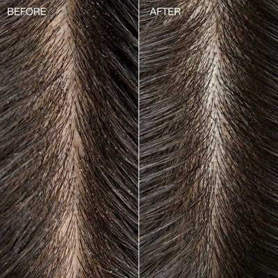 Tea Tree Special Detox Foaming Salt Hair Scrub 6.5oz - New