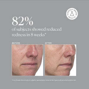 Naturium Azelaic Topical Acid 10% 1 fl oz - Imperfect Box