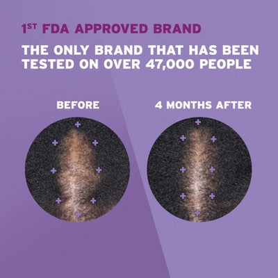 Women’s Rogaine 5% Minoxidil Foam for Hair Thinning and Regrowth 2.11oz