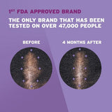 Women’s Rogaine 5% Minoxidil Foam for Hair Thinning and Regrowth 2.11oz