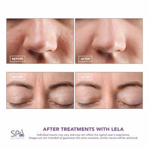 Spa Sciences LELA Ultrasonic Skin Scrubber Spatula Pink Imperfect Box