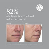 Naturium Azelaic Topical Acid 10% 1 fl oz - Missing Box