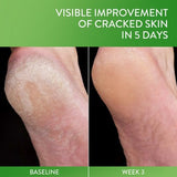 Cetaphil Cracked Skin Repair Balm Unscented - 3 fl oz