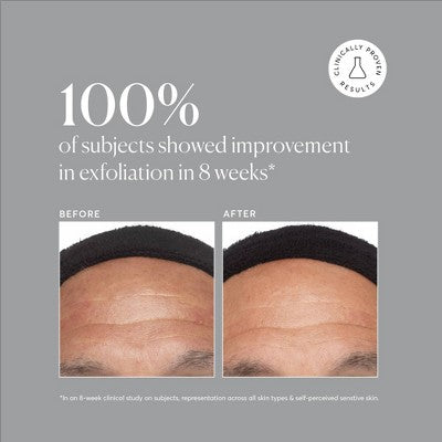 Naturium Azelaic Topical Acid 10% 1 fl oz - Missing Box