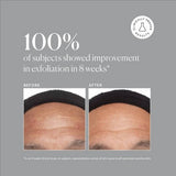 Naturium Azelaic Topical Acid 10% 1 fl oz - Missing Box