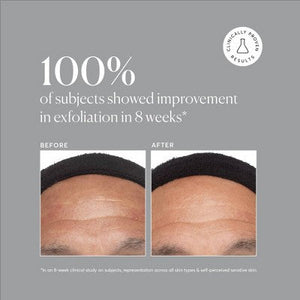 Naturium Azelaic Topical Acid 10% 1 fl oz - Missing Box