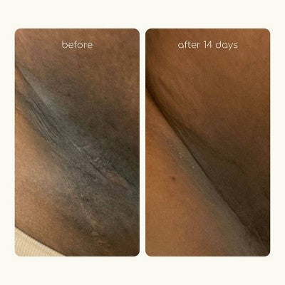 Forgotten Skincare The Original Underarm Brightening Deodorant Cream 1.7 fl oz - New