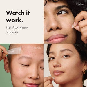 Hero Cosmetics Mighty Patch Variety Acne Pimple Patches 26ct