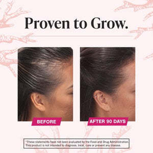 Viviscal Women's Hair Growth Supplement 60ct - Imperfect Box