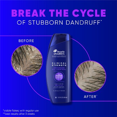 Head & Shoulders Clinical Strength Anti-Dandruff Citrus Shampoo 13.5 fl oz
