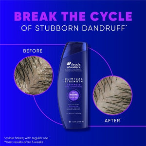 Head & Shoulders Clinical Strength Anti-Dandruff Citrus Shampoo 13.5 fl oz