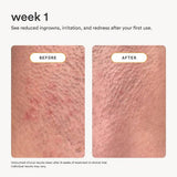 Nood After Care Serum 3.3 fl oz - New