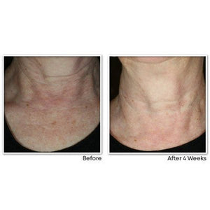 RoC Face & Neck Anti-Aging Moisturizer Firming Cream for Crepey Skin