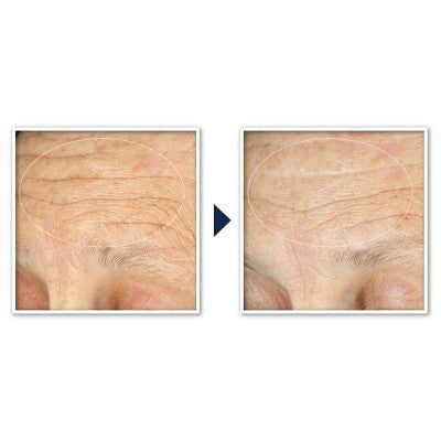 RoC Face & Neck Anti-Aging Moisturizer Firming Cream for Crepey Skin 1.7 fl oz - New