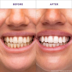 Hismile V34 Teeth Whitening Strips 14pk - Imperfect Box