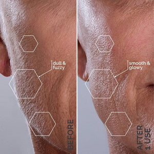 Spa Sciences SIMA Deluxe Sonic Dermaplaning Tool for Exfoliation & Peach Fuzz Removal