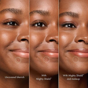 Hero Cosmetics Mighty Shield Liquid Patch Invisible Blemish Protectant 10ml - Imperfect Box