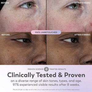 Olay Super Face Serum with Vitamin C 1 fl oz - Imperfect Box
