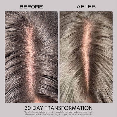 Jupiter Anti-Dandruff Restoring Scalp Serum 2.1 fl oz