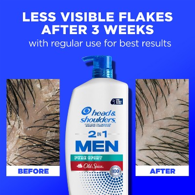 Head & Shoulders Men's 2-in-1 Shampoo and Conditioner 28.2 fl oz