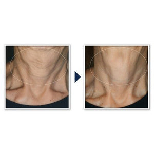 RoC Face & Neck Anti-Aging Moisturizer Firming Cream for Crepey Skin