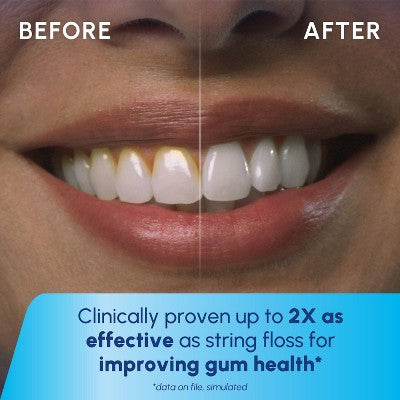Waterpik Cordless Plus Water Flosser - Imperfect Box